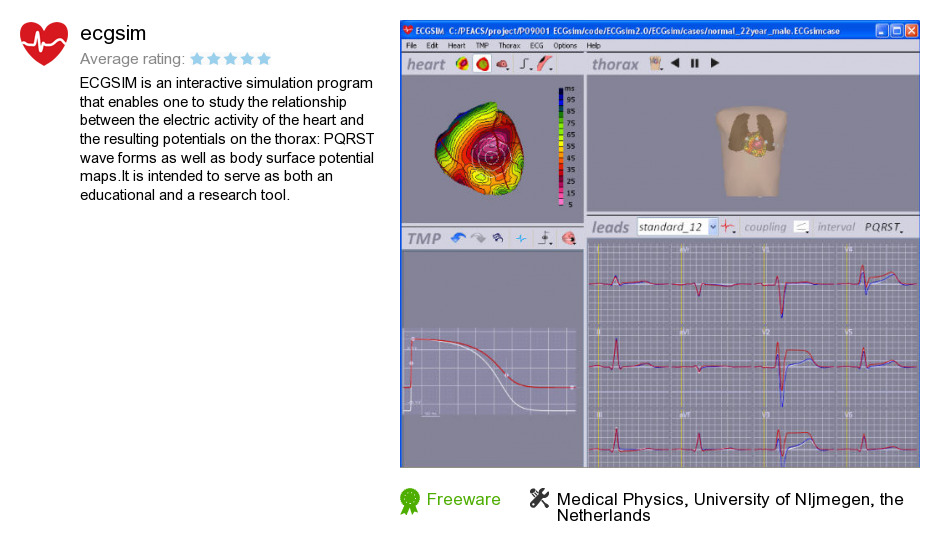 Ecgsim